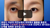 꺼진눈 교정에 가장 효과적인 방법은? 눈지방이식? 아니면 눈지방재배치? 그 정답을 알려드립니다.