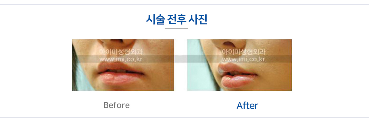 이미지명