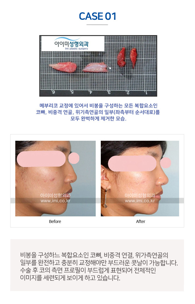 이미지명