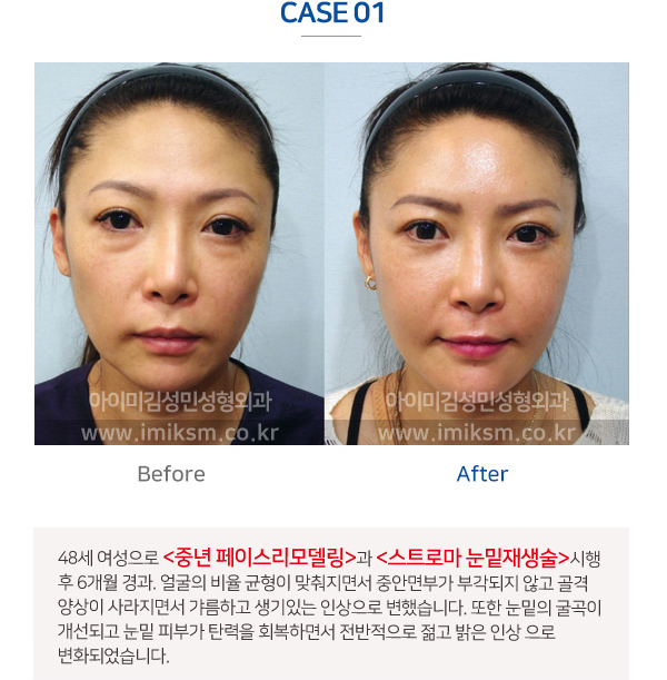 이미지명