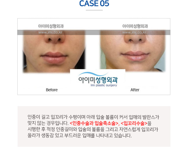 이미지명