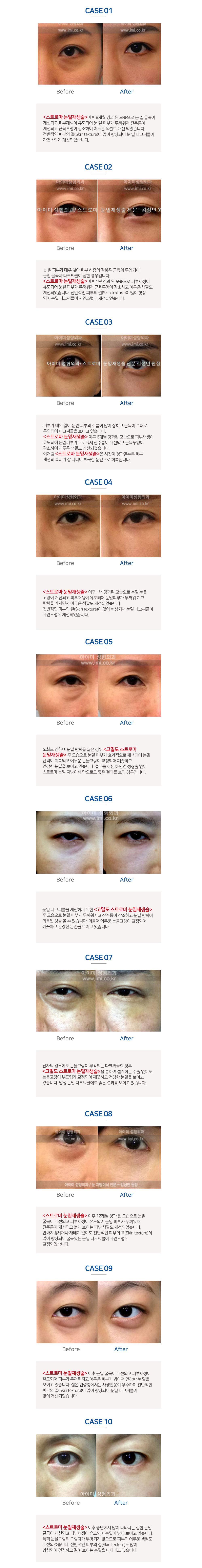 이미지명