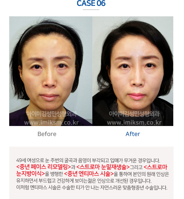 이미지명