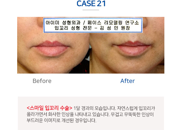 이미지명