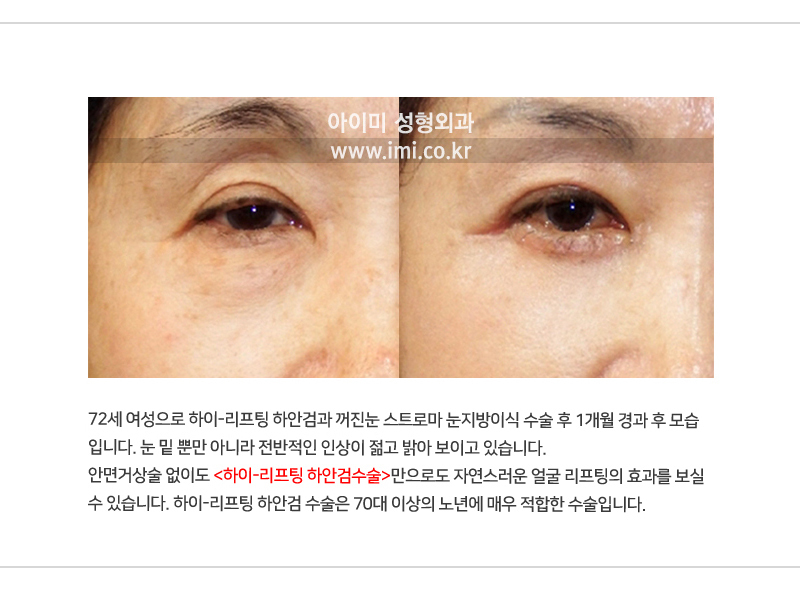이미지명