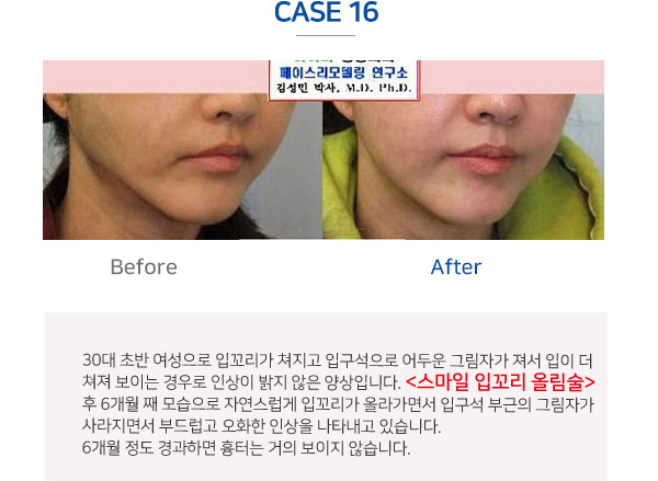 이미지명