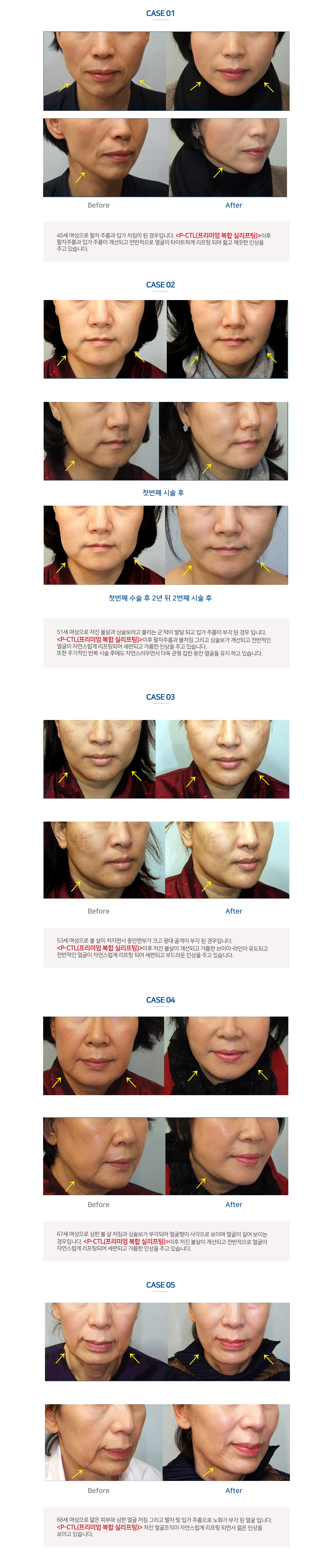 이미지명