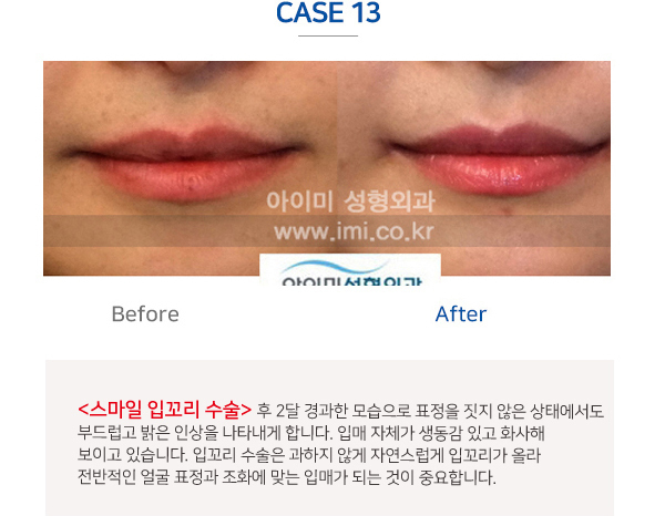이미지명