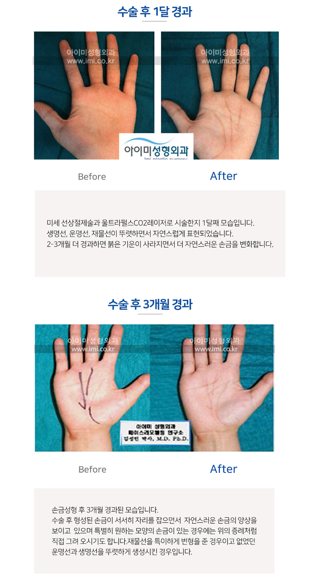 이미지명