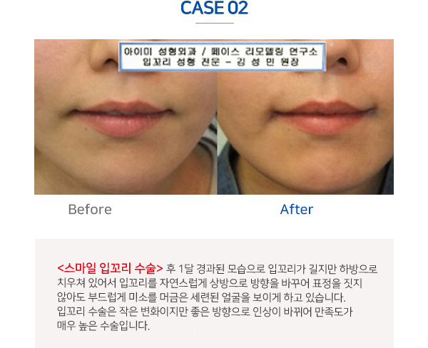 이미지명