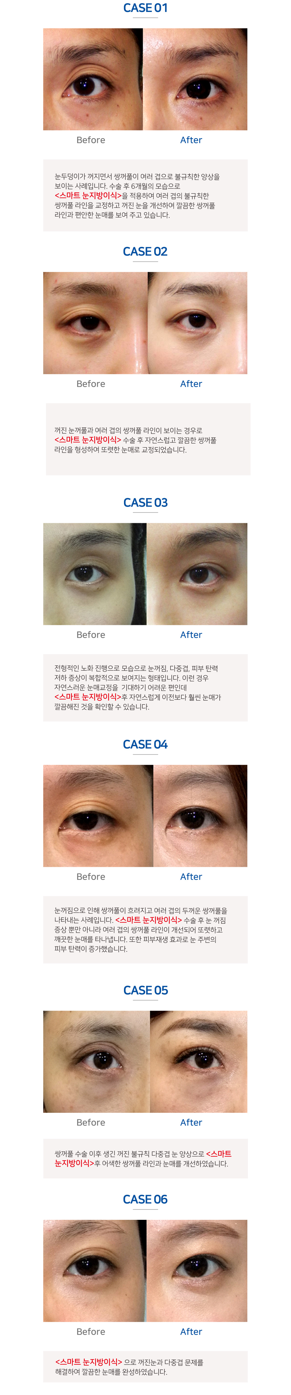 이미지명