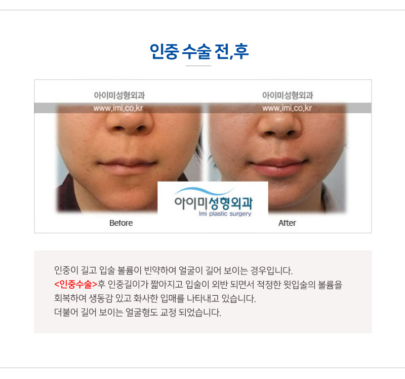 이미지명