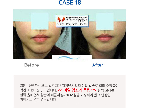 이미지명