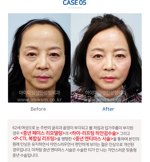 이미지명