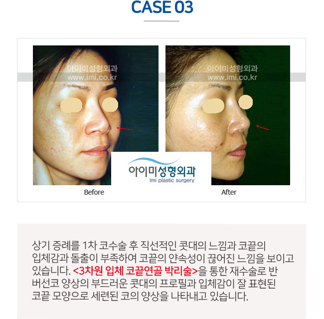 이미지명