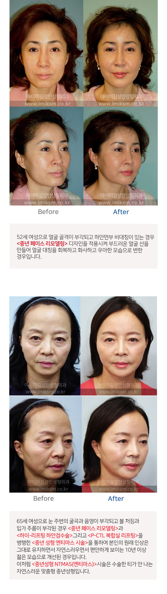이미지명
