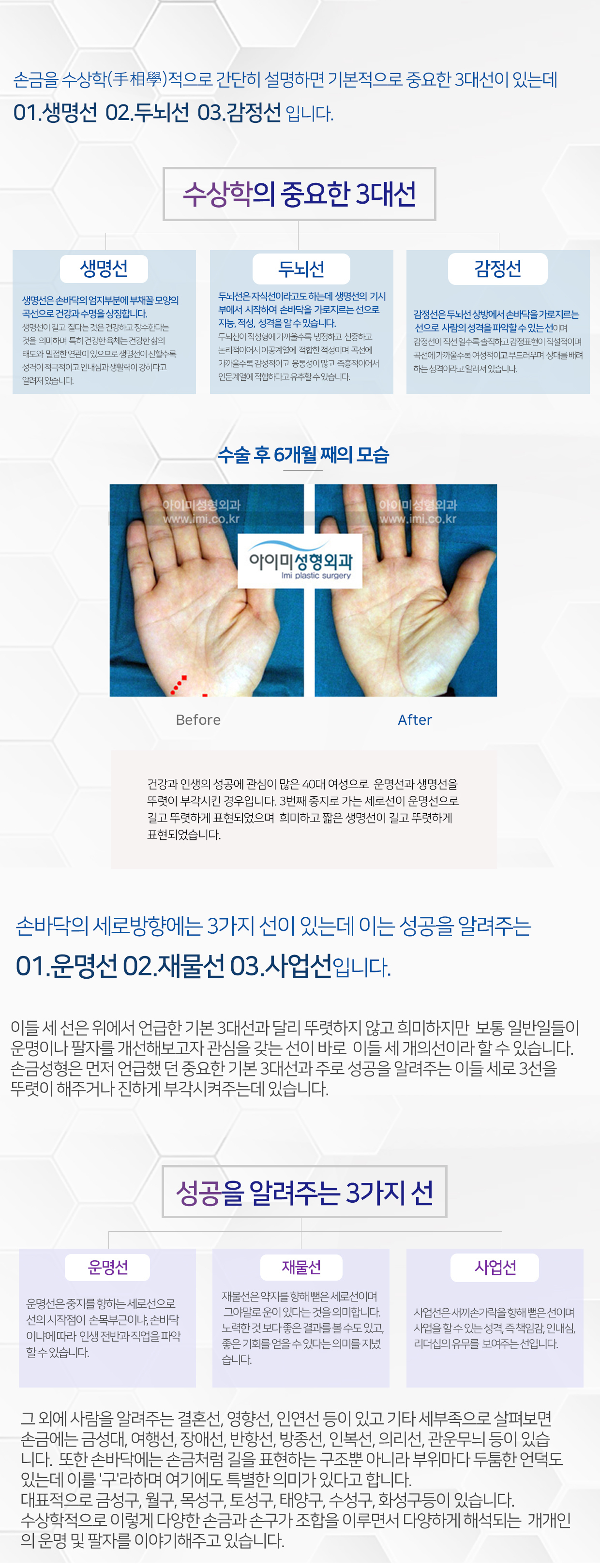 이미지명
