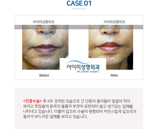 이미지명