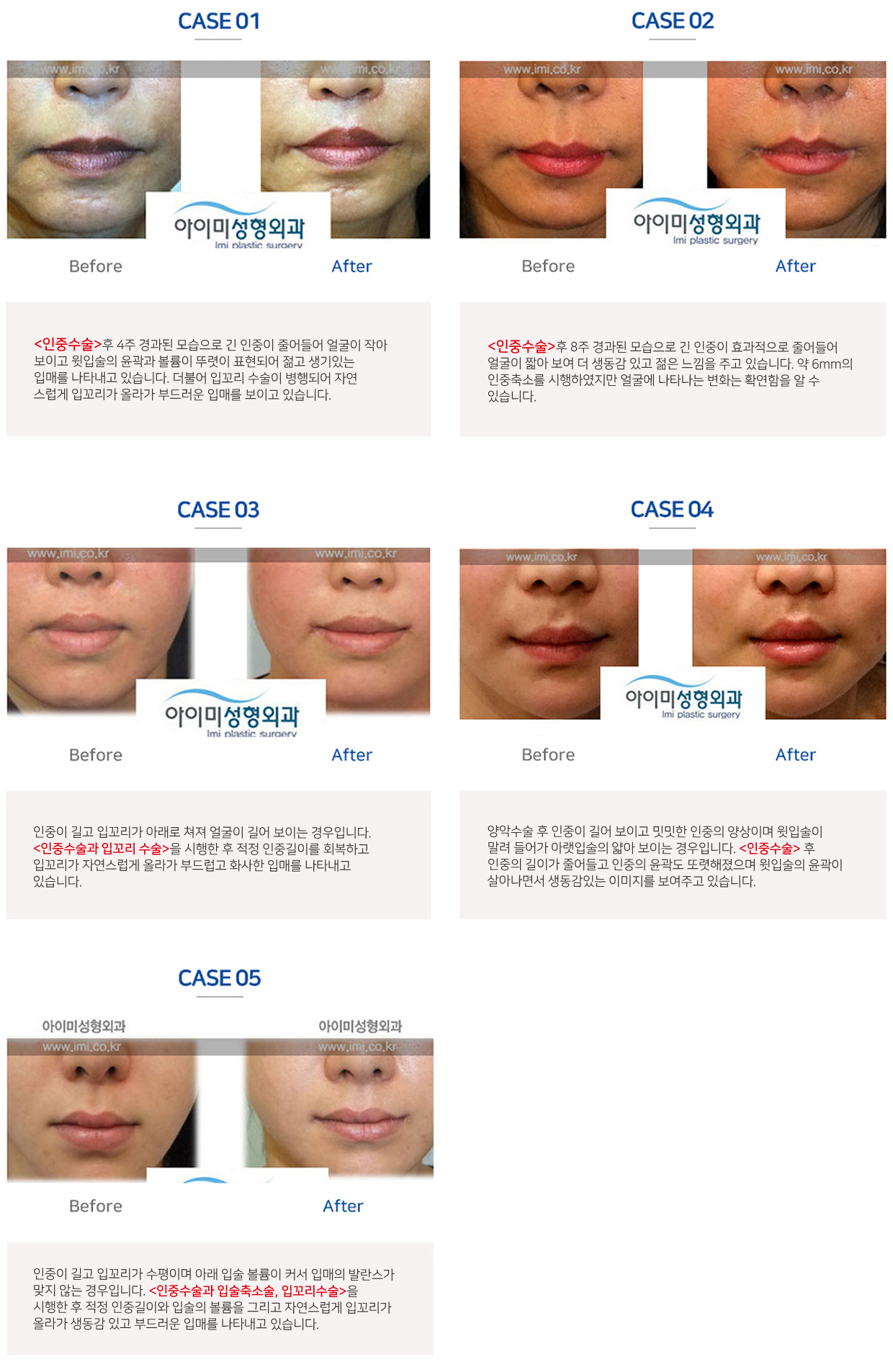 이미지명