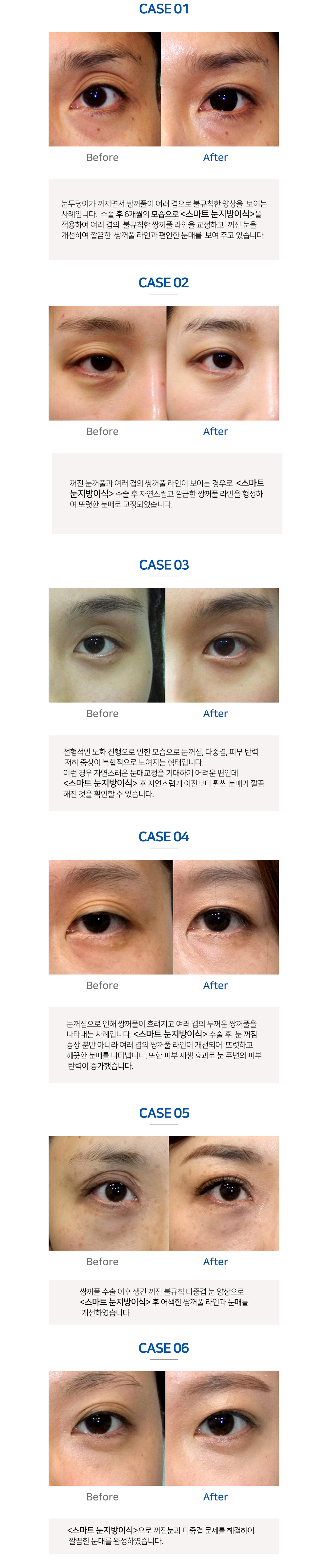 이미지명