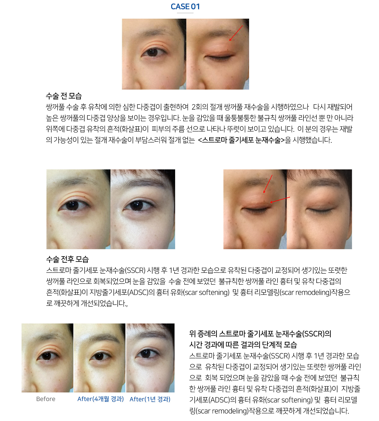 이미지명