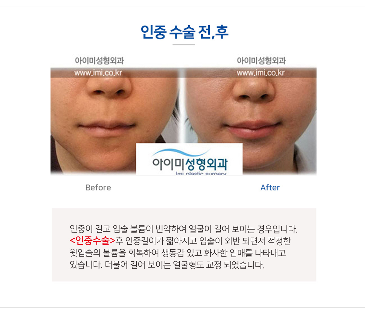 이미지명