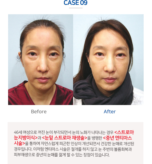 이미지명