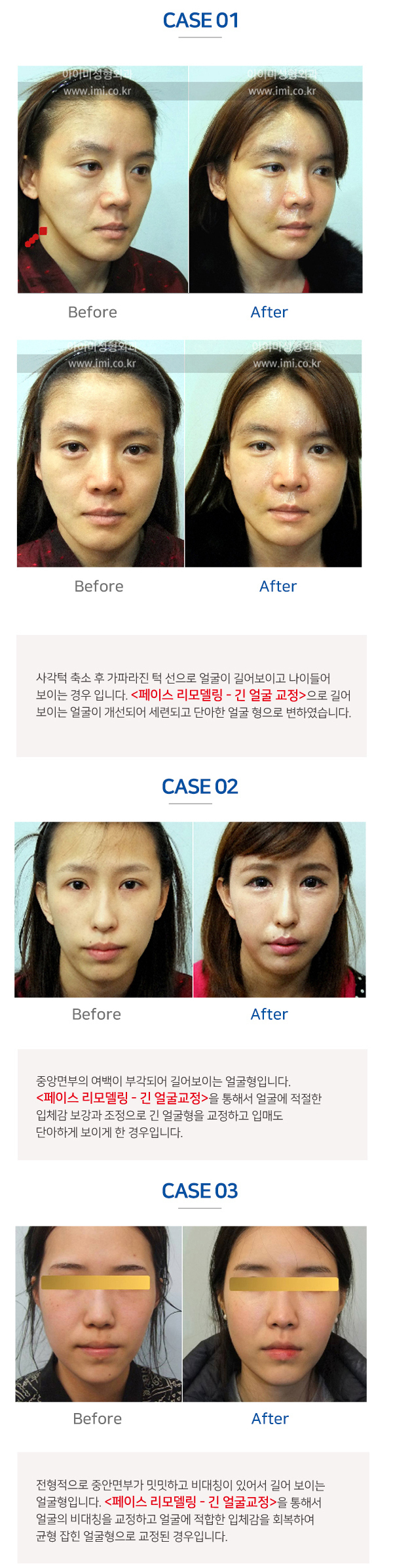 이미지명