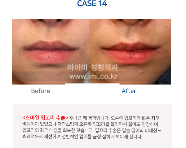 이미지명