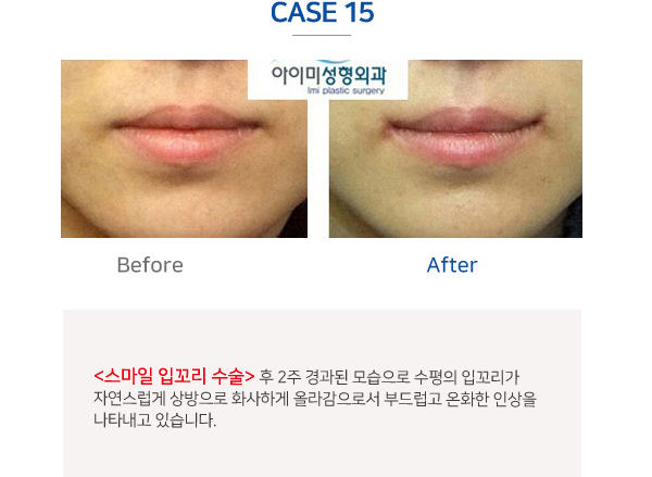 이미지명