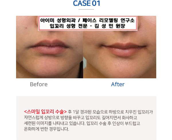 이미지명