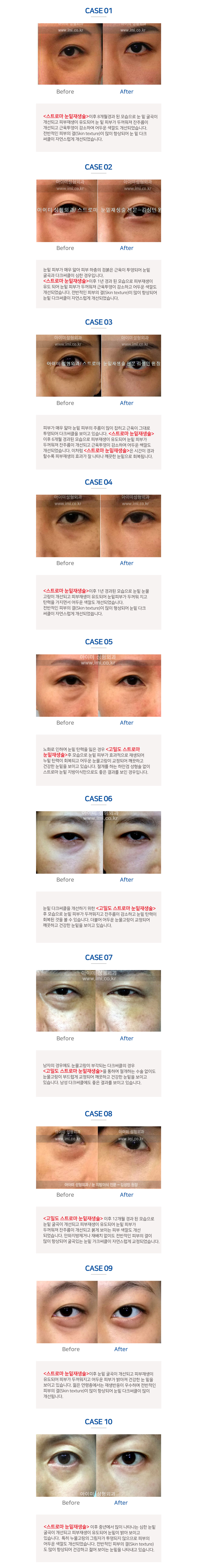 이미지명