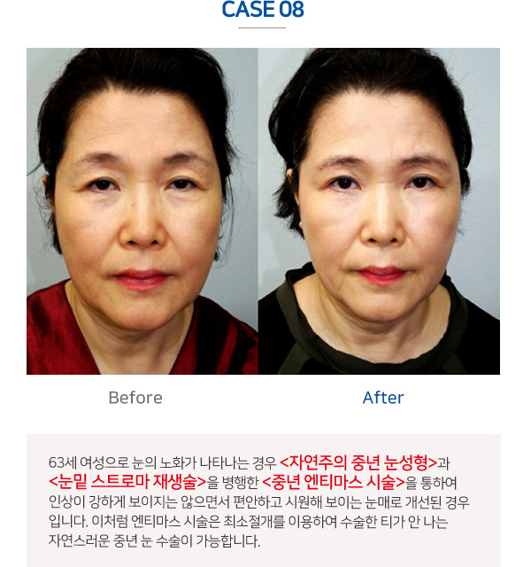 이미지명
