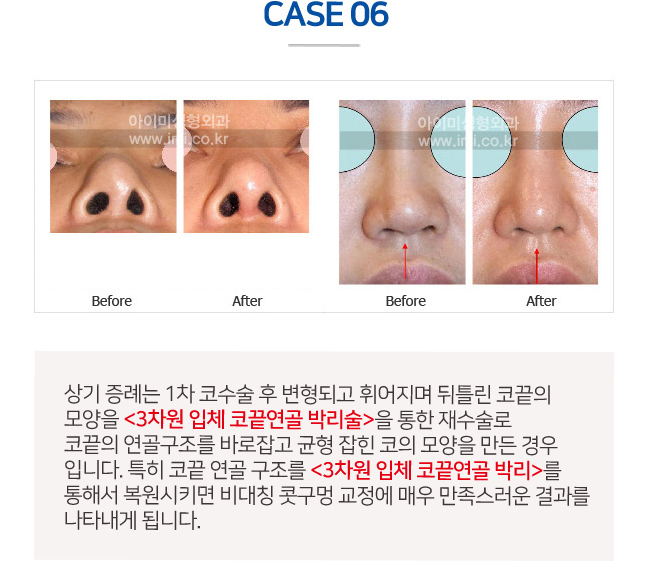 이미지명