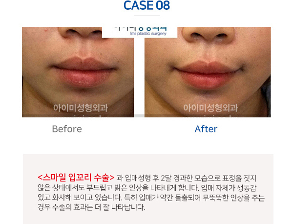 이미지명