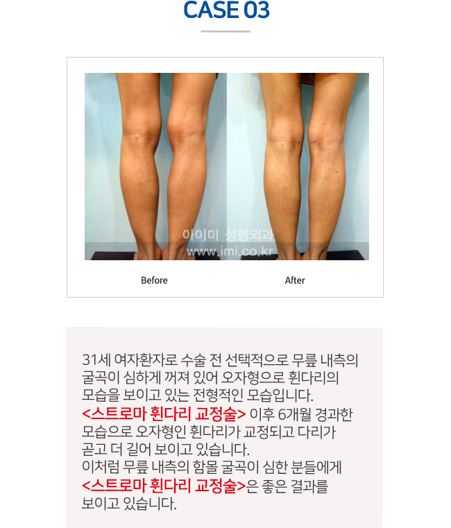 이미지명