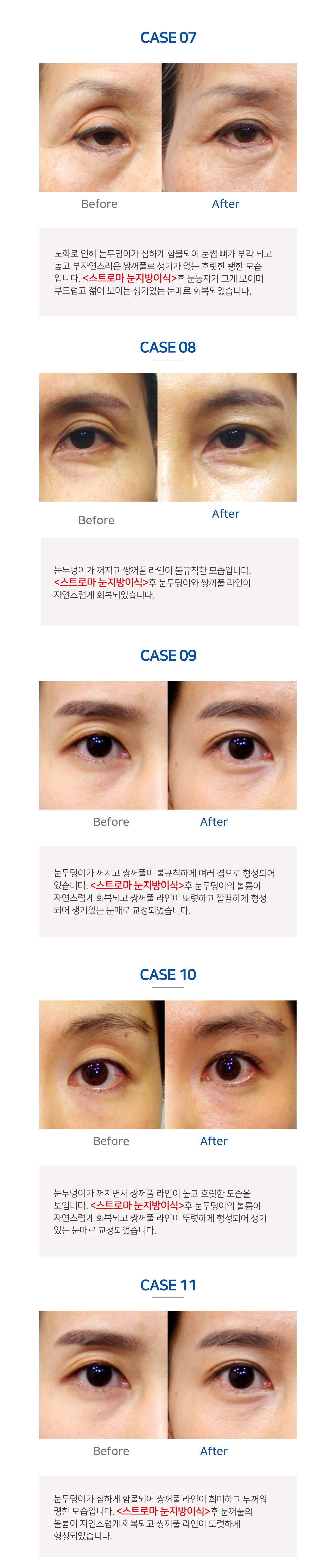 이미지명