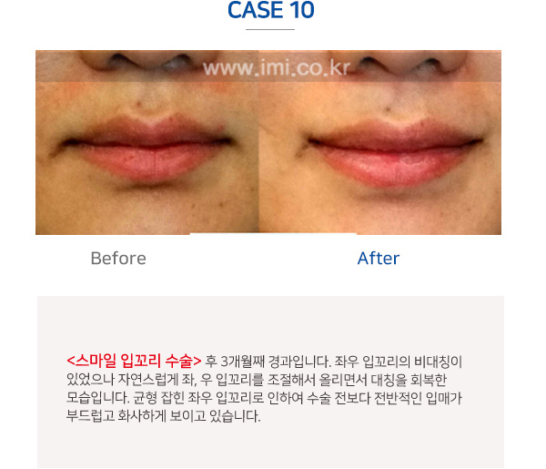 이미지명