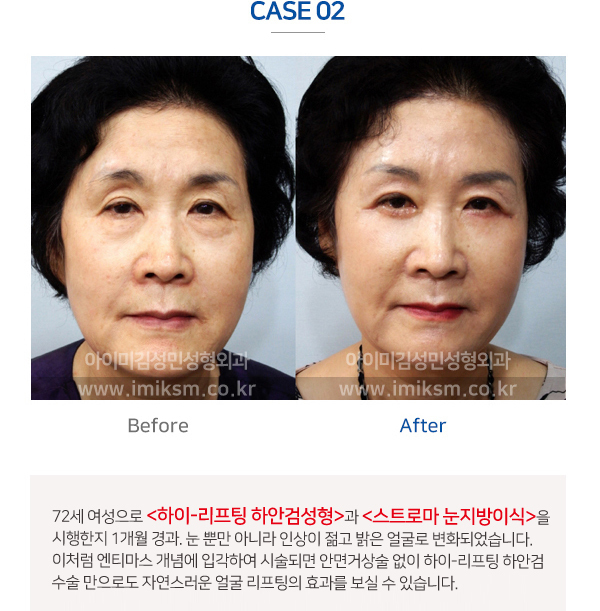 이미지명