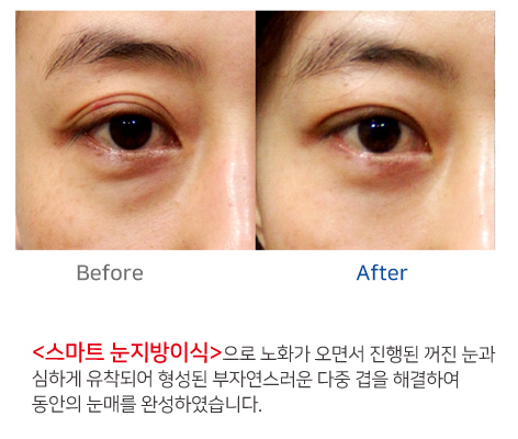이미지명