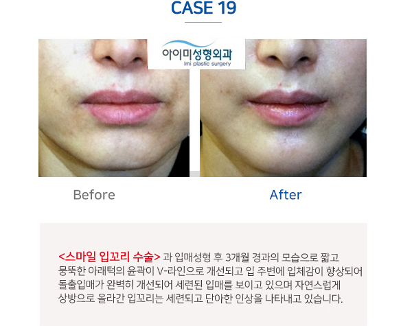 이미지명