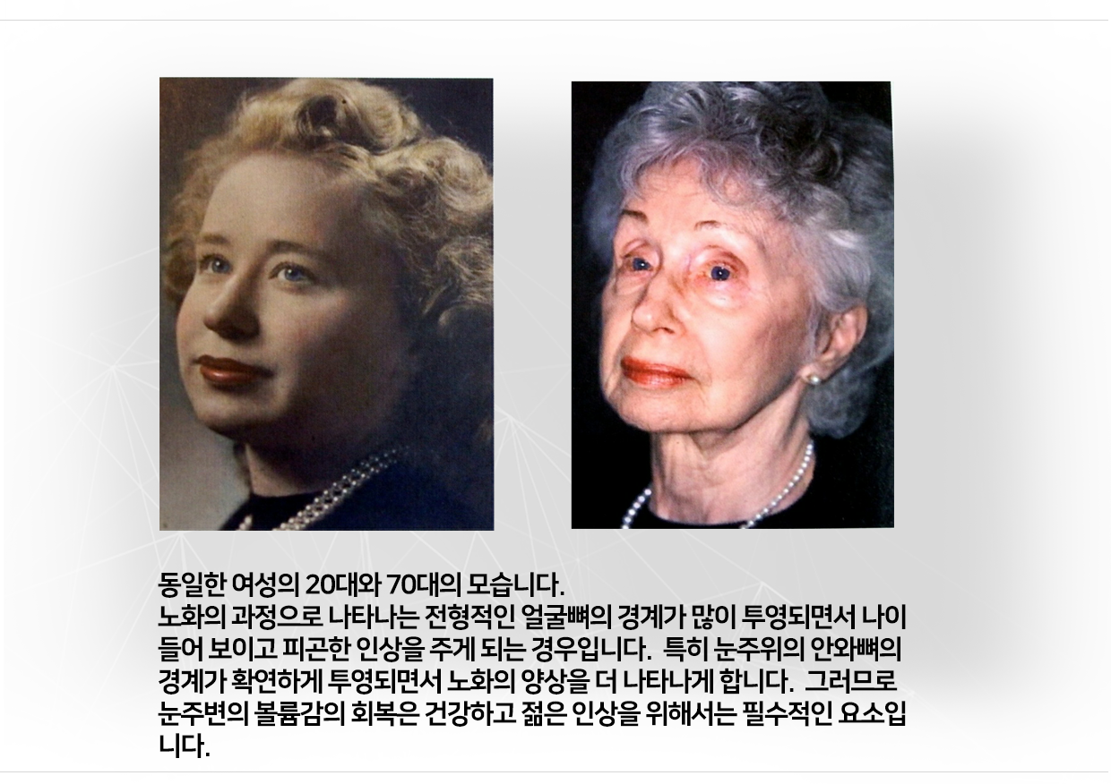이미지명