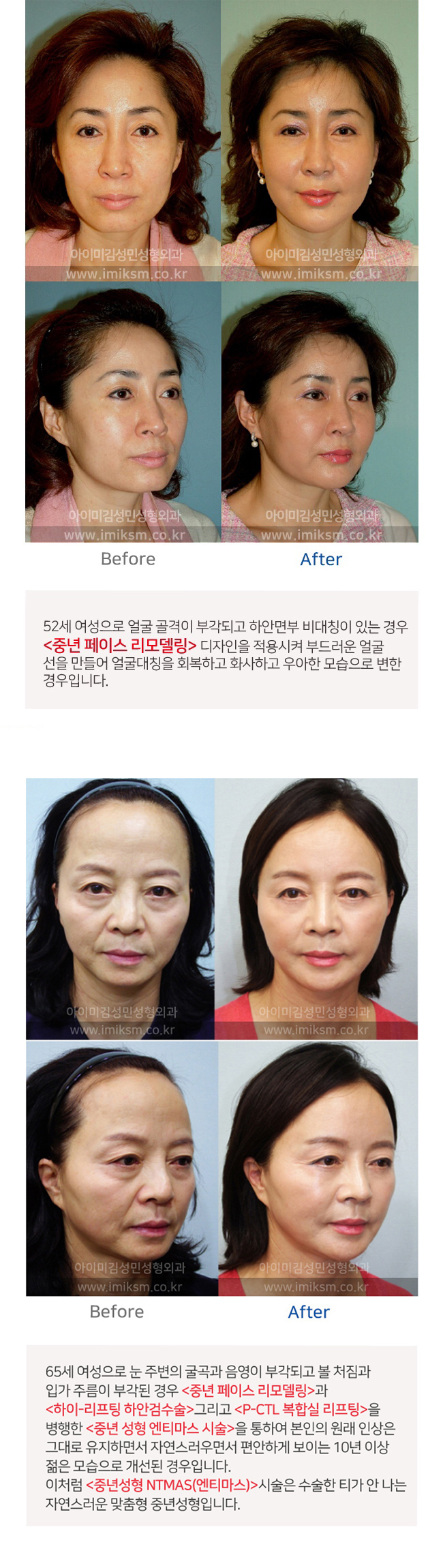 이미지명