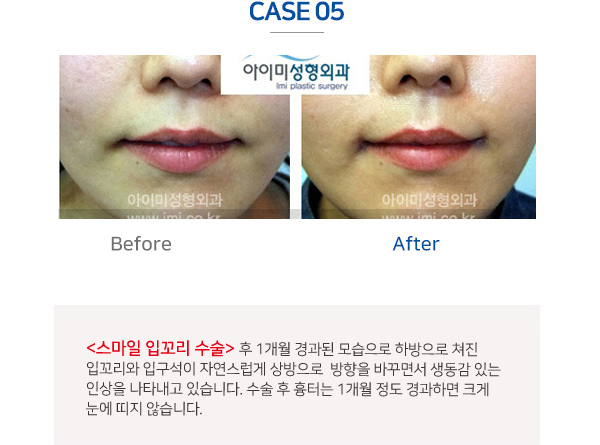 이미지명