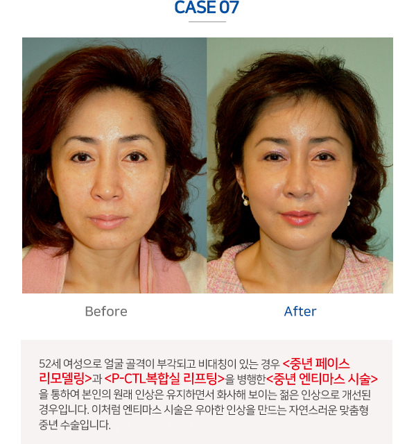 이미지명