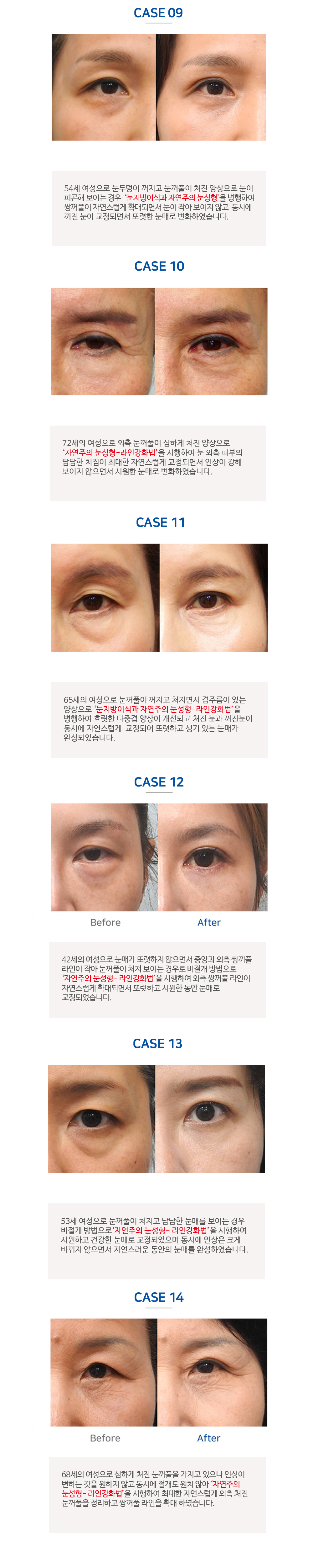 이미지명