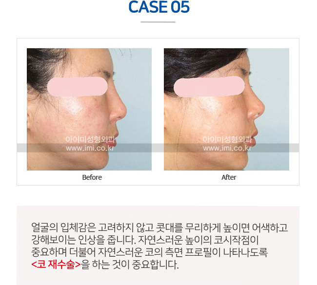 이미지명