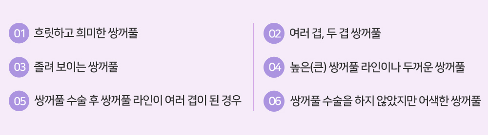 이미지명