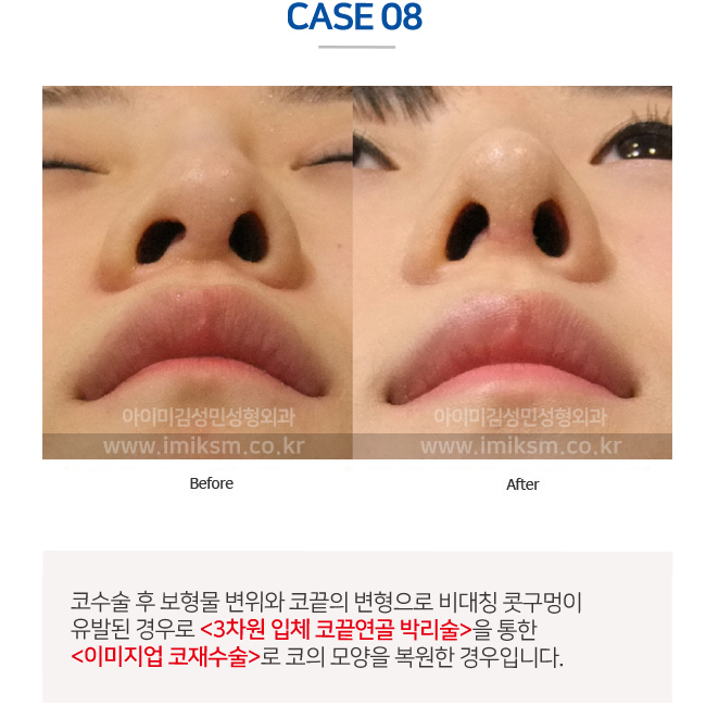 이미지명