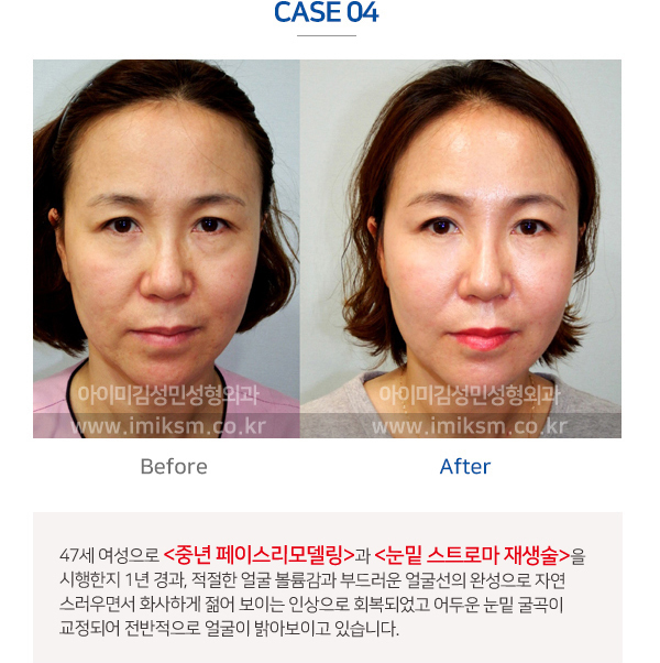 이미지명